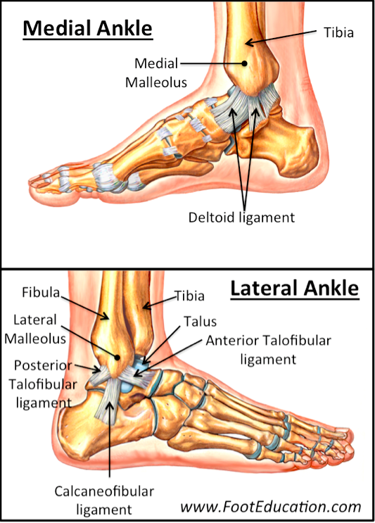 Medial Malleolus Fracture and Broken Ankle Treatment